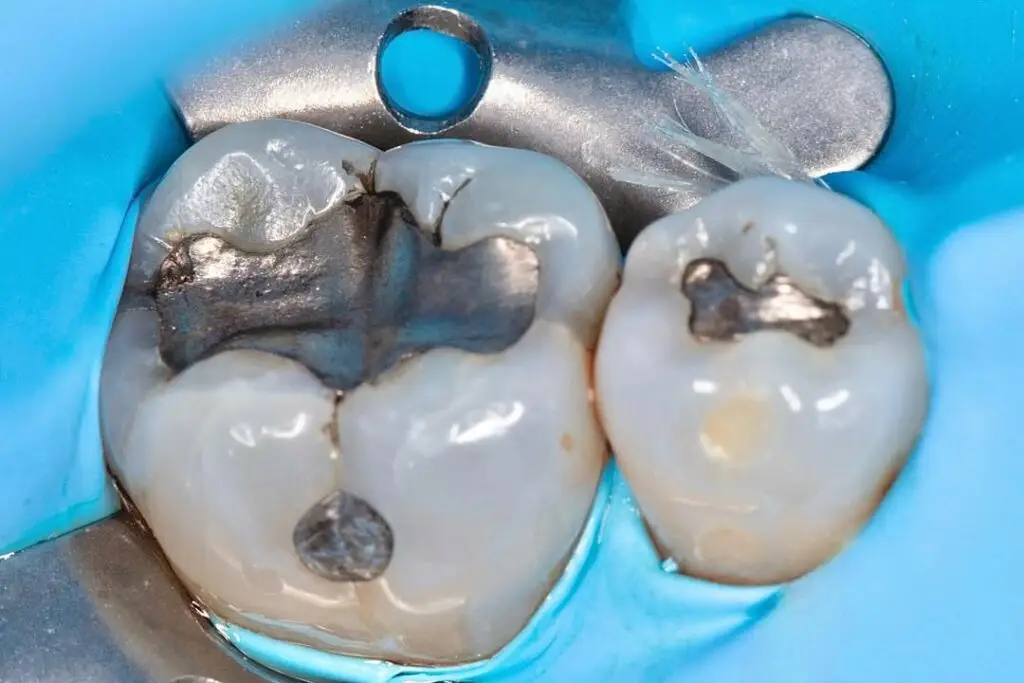 Metallfreie Zahnmedizin