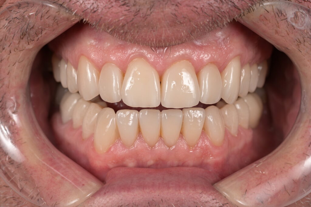 Mock-up – der Test Drive