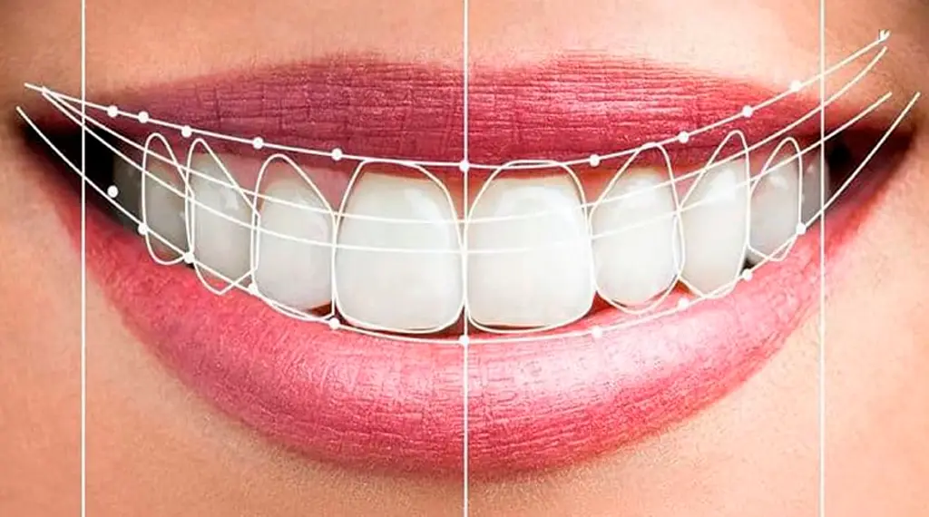 Ästhetische Zahnmedizin