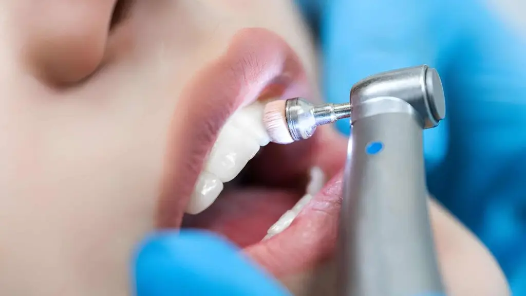 Zahnreinigung Prophylaxe