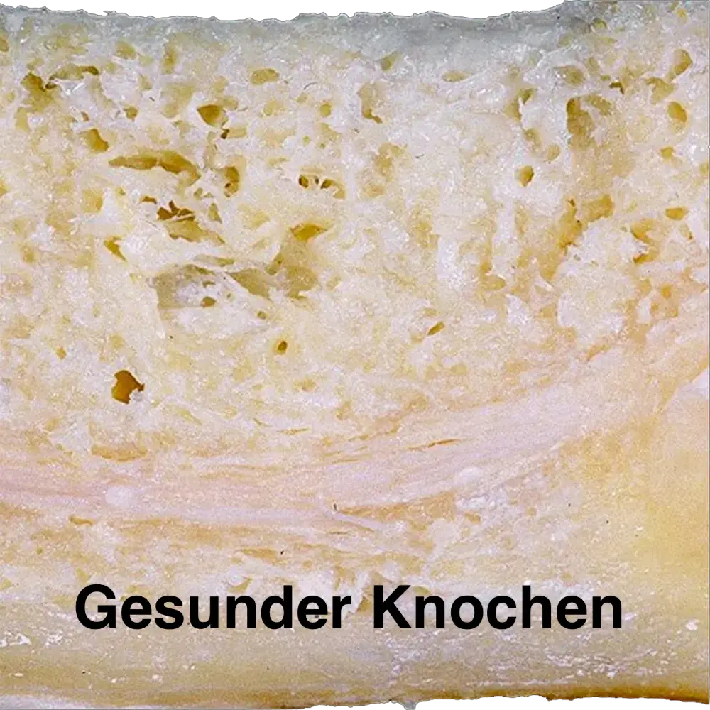 Herd- und Störfeldsanierung (FDOK / NICO)