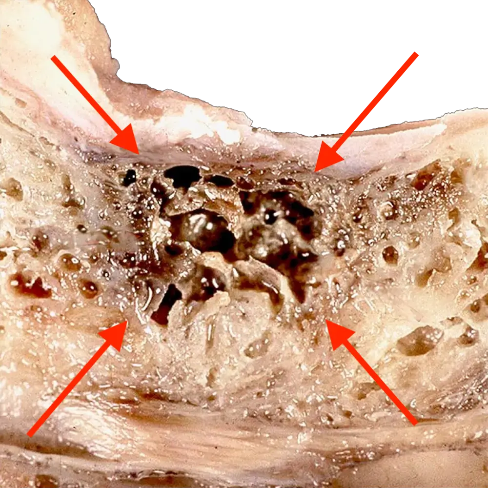 Herd- und Störfeldsanierung (FDOK / NICO)